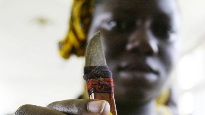 infibulazione-valvibrata