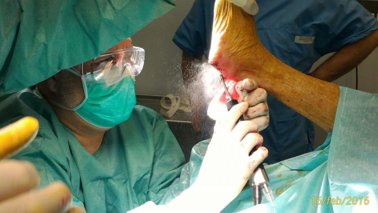 Gustavo-Velasquez.InterventoSuPiedeDiabetico